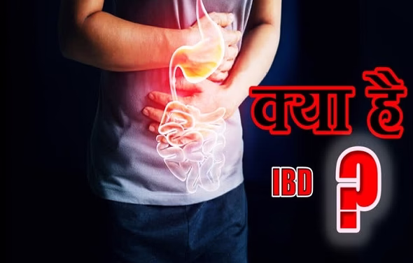 IBD रोग से सावधान ! जानिए लक्षण और इलाज