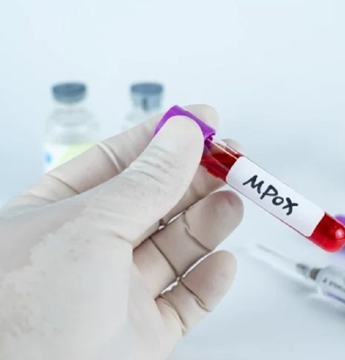 अगर यह बीमारी यहां से बाहर गई तो दुनिया में मचा सकती है तबाही