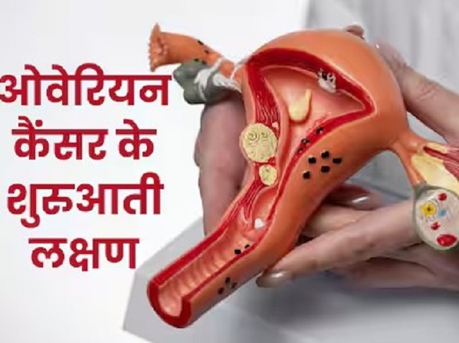 कम उम्र में भी महिलाओं को हो सकता है ओवेरियन कैंसर,,जाने एक क्लिक में..